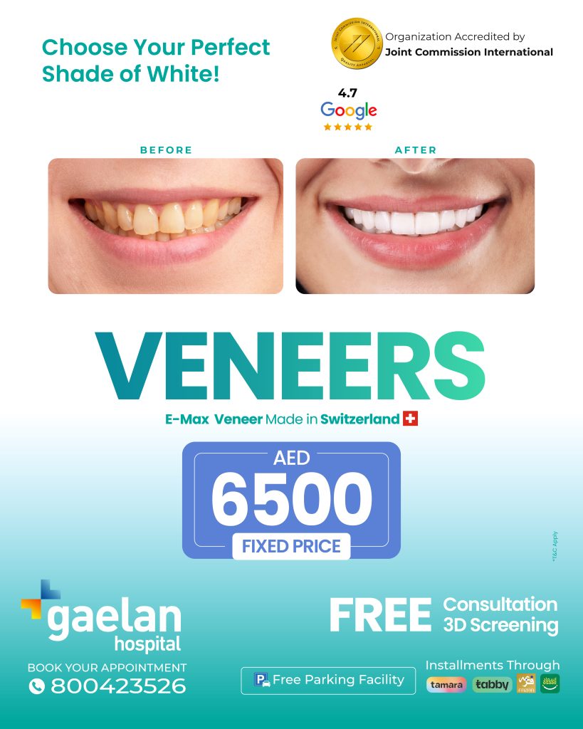 Veneers package at Gaelan Hospital Sharjah with E-Max veneers made in Switzerland, before and after photos, AED 6500 fixed price, free consultation