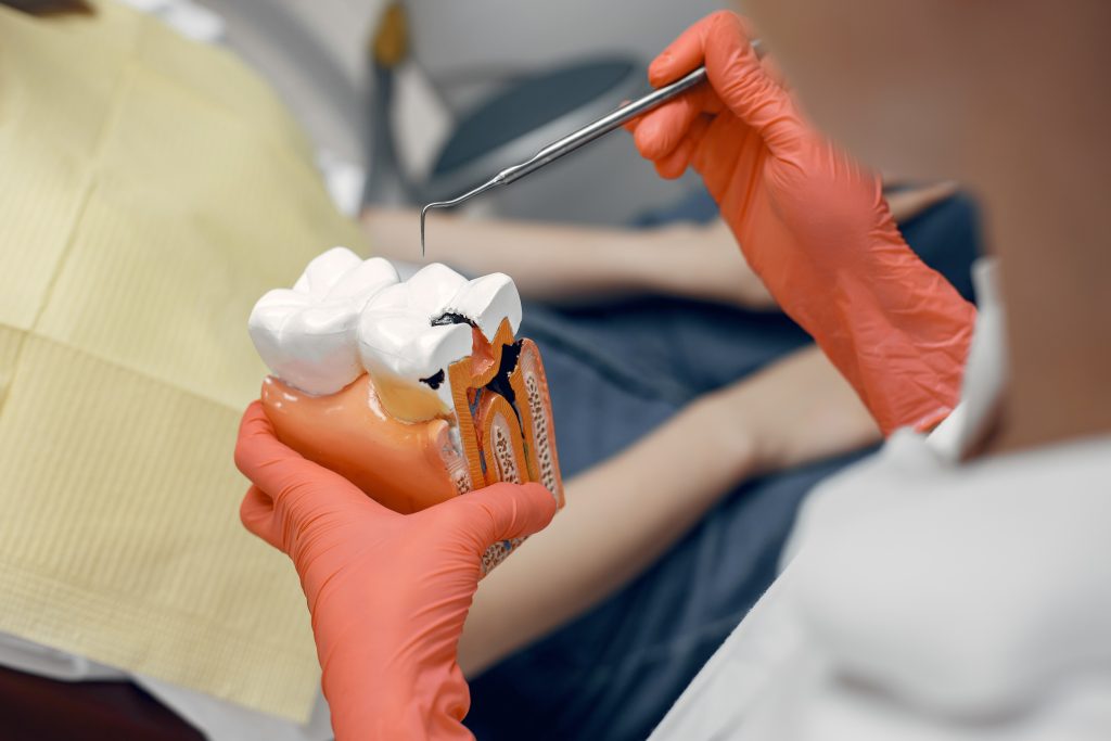 Dentist showing a tooth model with root canal infection during dental consultation at Gaelan Hospital Sharjah